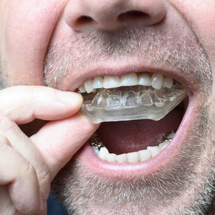mouthguard