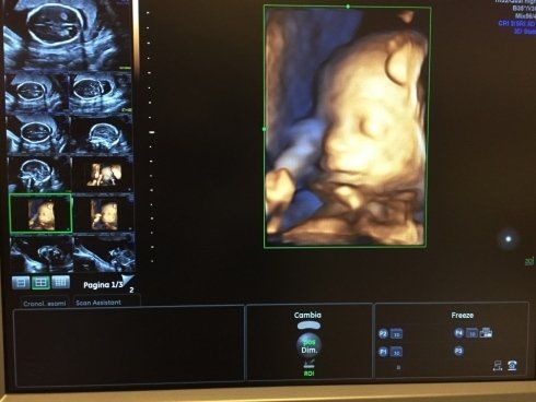 Echography tridimensionale del beve e un primo piano spettacolare dopo un altro angolo