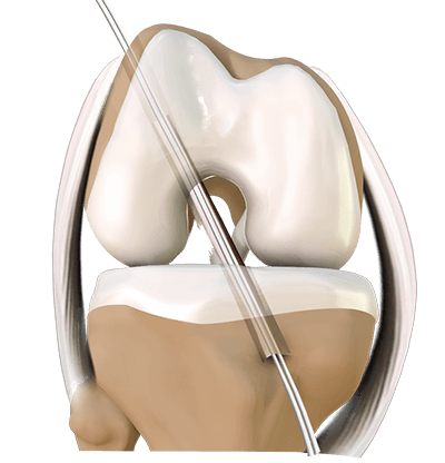 Dr Edward Graham, Hip & Knee Surgeon Sydney