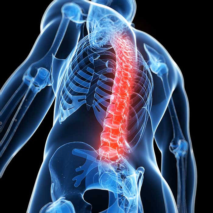 Back Pain — Law Firm in Modesto, CA Back Pain — Law Firm in Modesto, CA