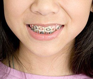 girl smile up close