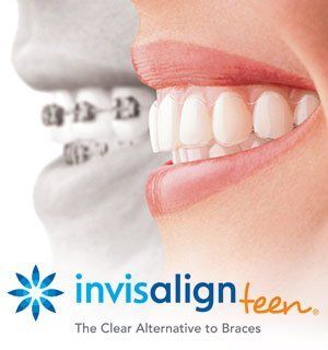 invisalign teen
