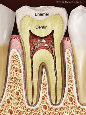 root canal