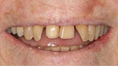 before and after sewell dental