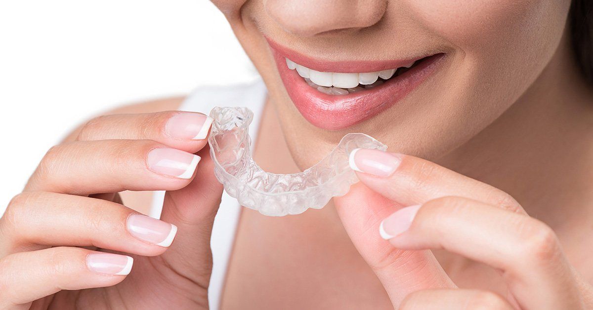Invisalign vs braces, Invisalign vs braces which is faster, Invisalign vs braces cost