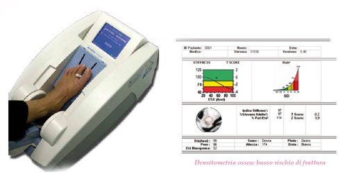 densi check