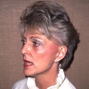 Facelift Dr. Joel Rein