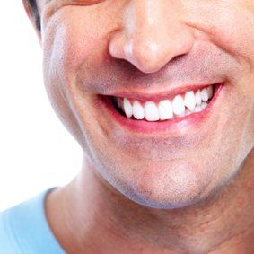 Teeth Whitening