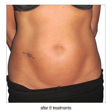 abdomen
