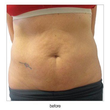 abdomen
