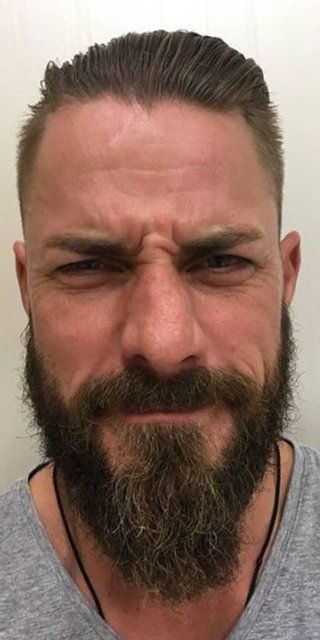 scar