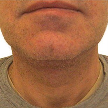 neck
