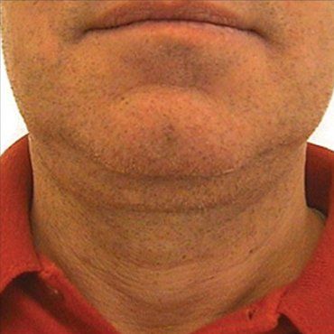 neck