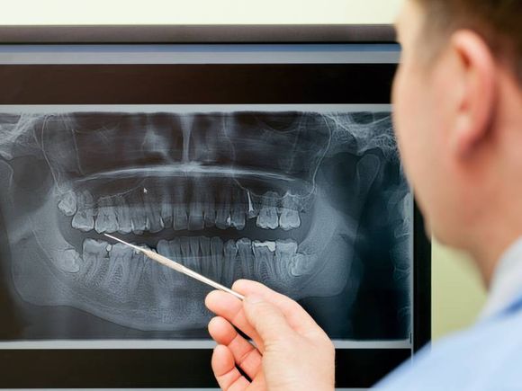 radiografia dentale