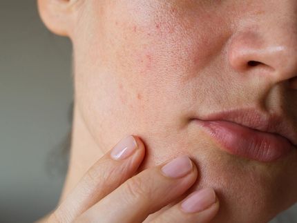 Skin — Surgical Care in North Mackay, QLD