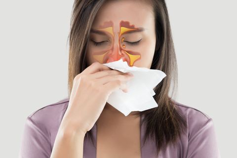 Balloon Sinuplasty — Women Feeling Unwell and Sinus in Redding, CA Balloon Sinuplasty — Women Feeling Unwell and Sinus in Redding, CA