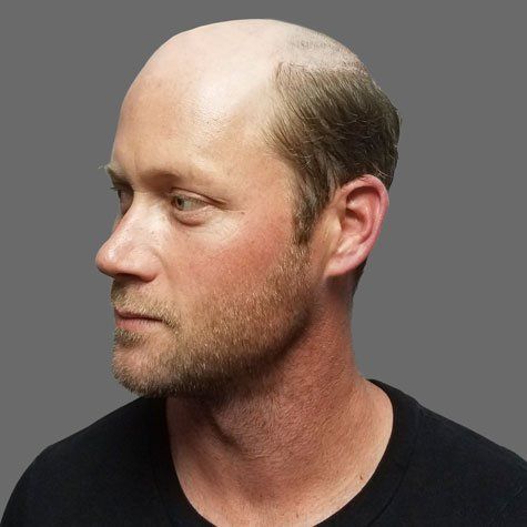 Men's hair piece before placement