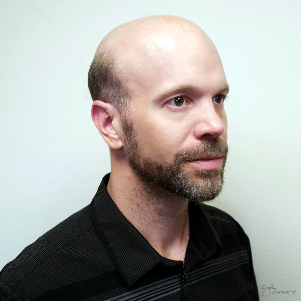 Men's Hair Piece before image