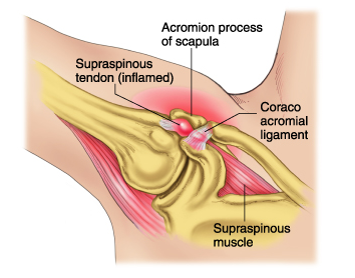 A diagram showing the acromion process of the scapula