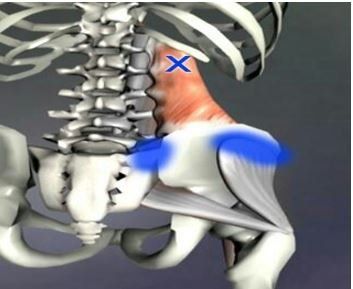 Trigger Points