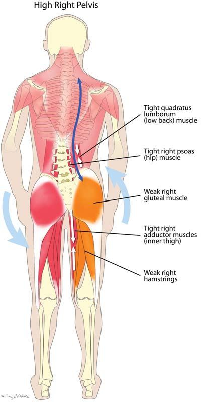 A diagram of a man 's back and lower back muscles.