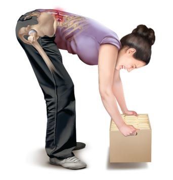 Lower Back Pain