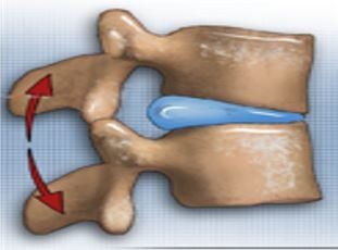 Disc Pain
