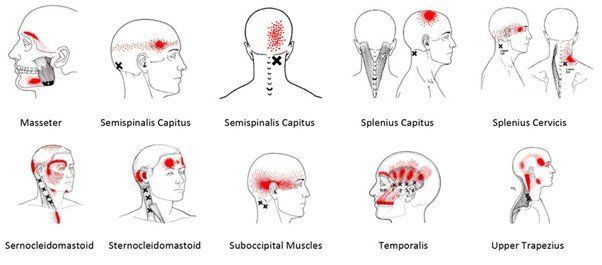 Disc Injuries