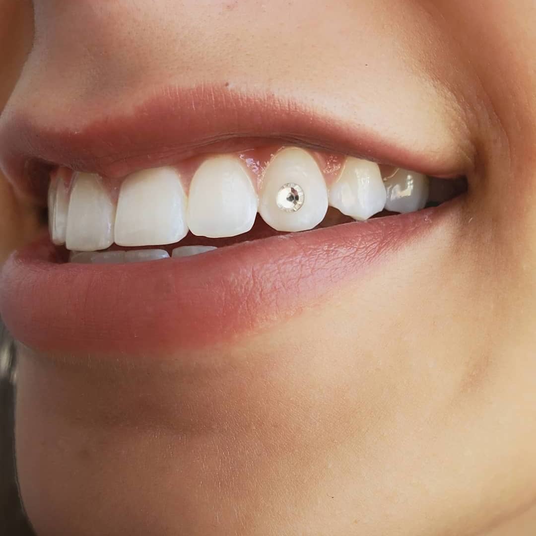 Crystal tooth gem adhered to a tooth at Ikonik Ink