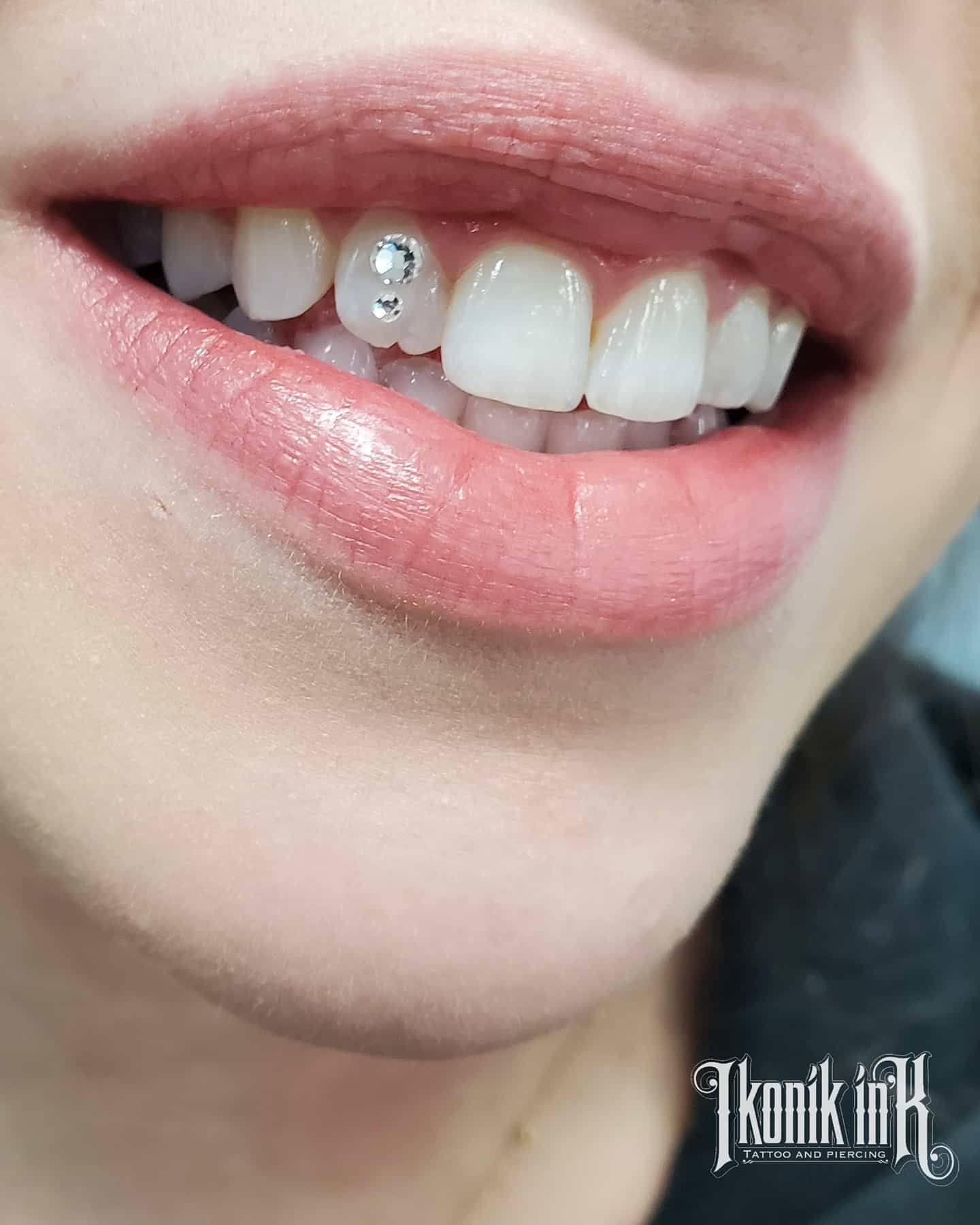 Tooth gem detail on a smile by Ikonik Ink, Lakewood CO