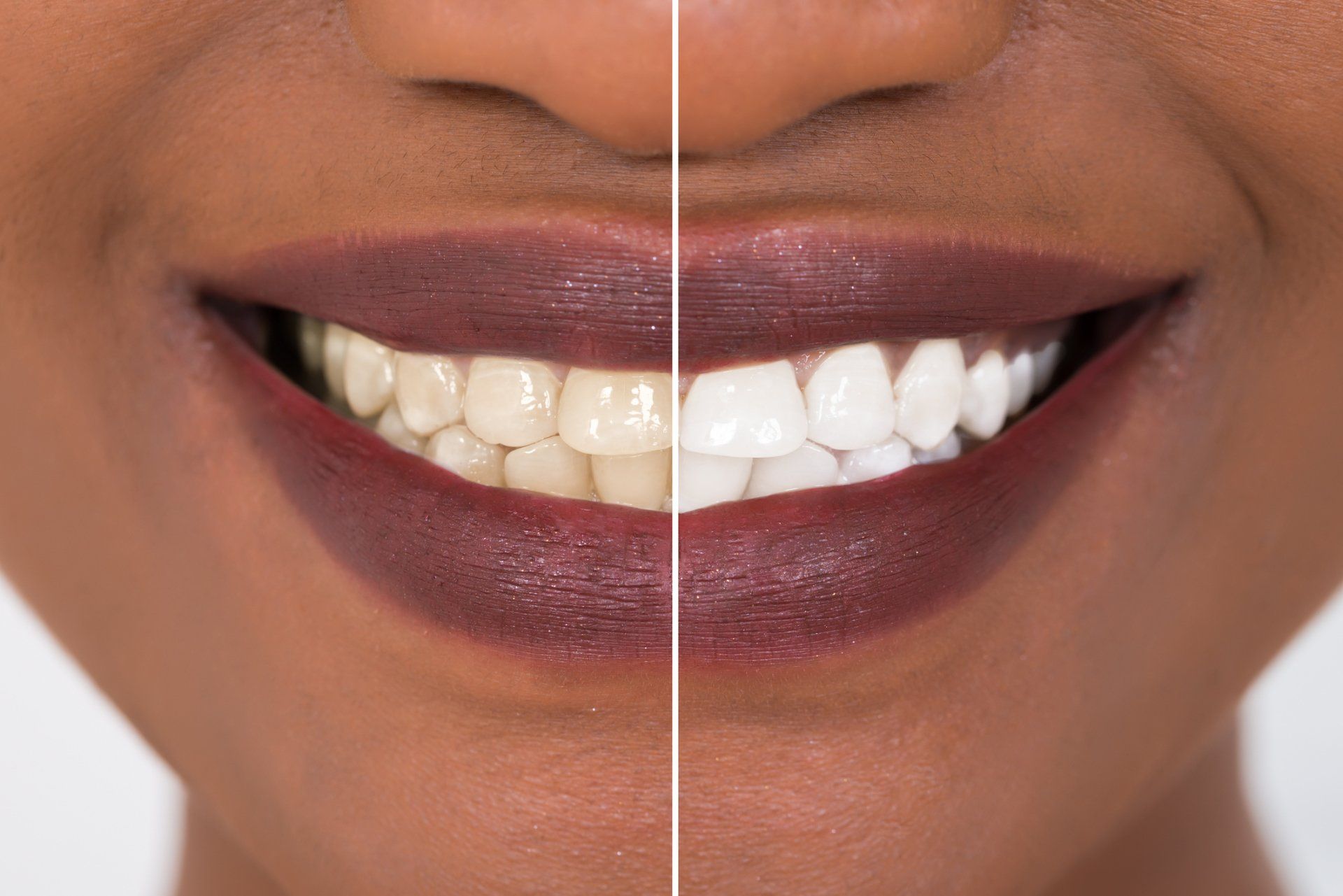 Dentist — Cosmetic Dentistry in Terre Haute, IN