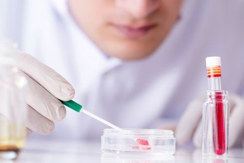 Prelievo di un campione per analisi
