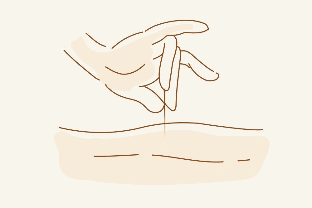 Acupuncture