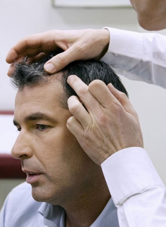 Scalp Analysis