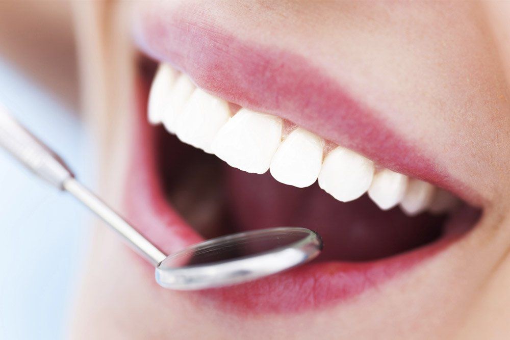 Smile after teeth whitening in Melbourne, CBD