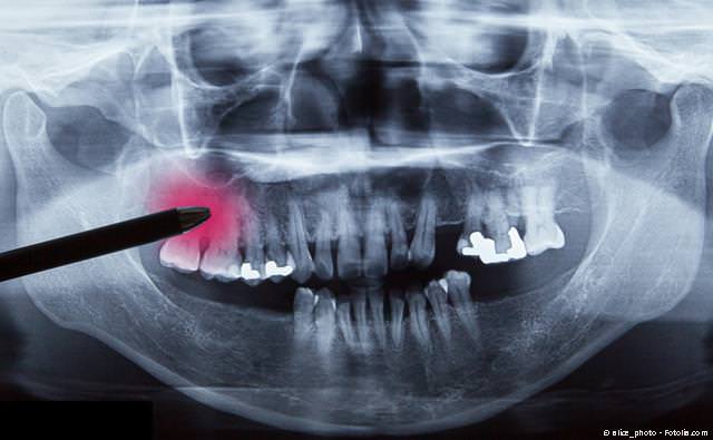 Röntgenologische Diagnose vor einer Operation Röntgenologische Diagnose vor einer Operation