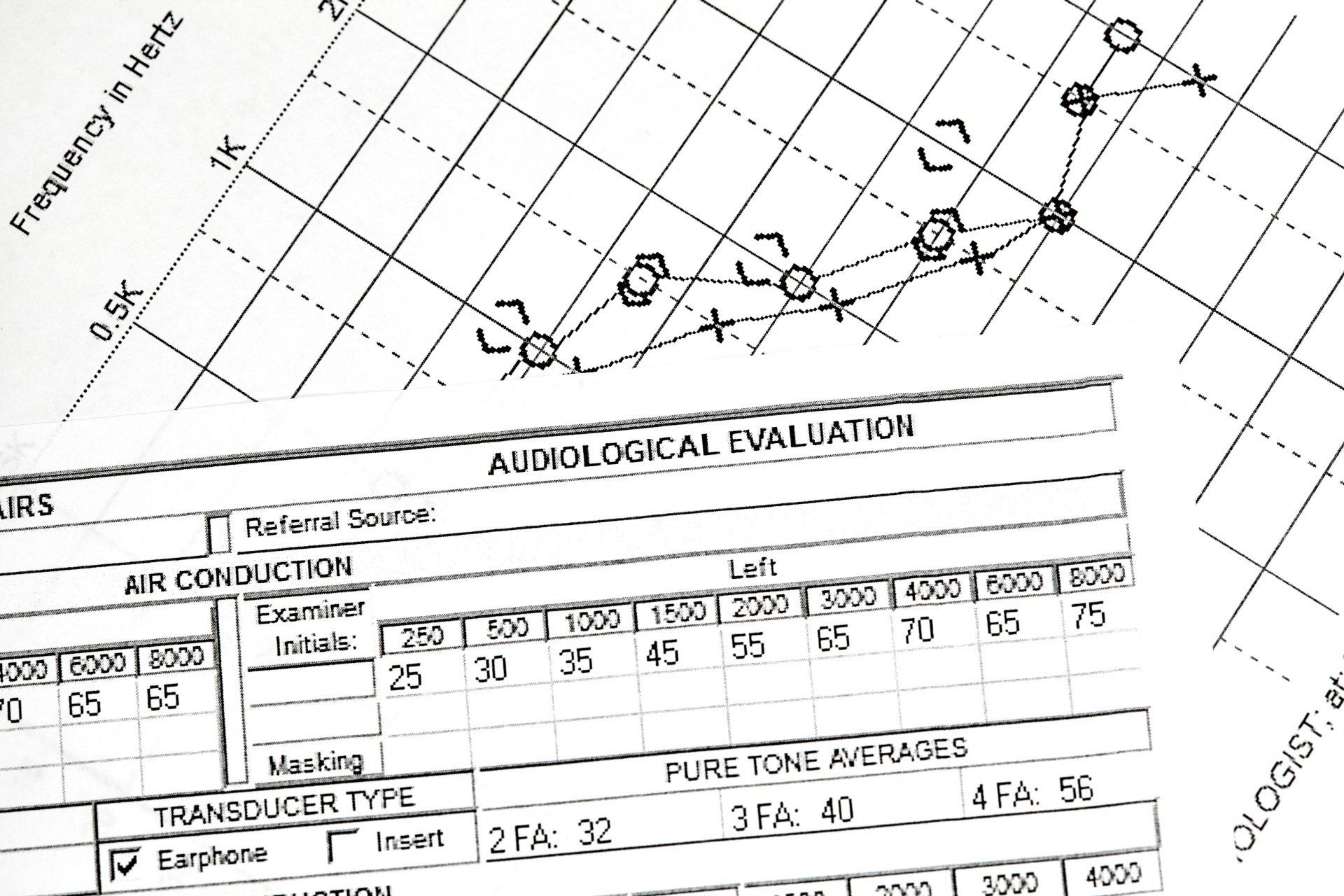 Hurdle Hearing | Hearing Aids | Audiology | Arroyo Grande | Santa Maria