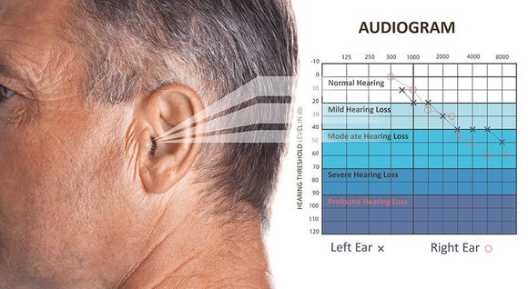 Esami audiometrici