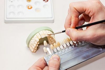 Teeth Shades - Whitening in West Berlin, NJ Teeth Shades - Whitening in West Berlin, NJ