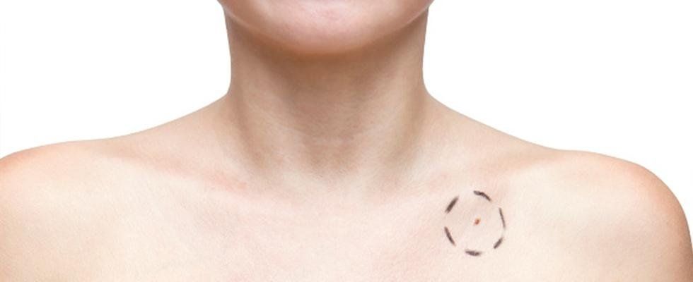 trattamenti malattie della pelle