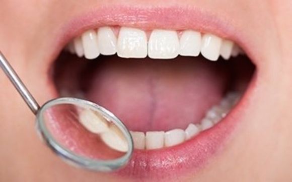 Denti puliti
