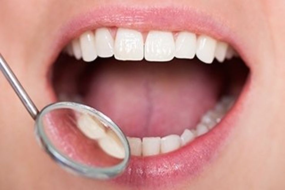 Visita denti