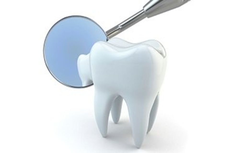Modello dente