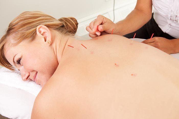 Acupuncture, London