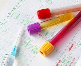 Medical specimens - Drug testing services in Little Falls, MN Medical specimens - Drug testing services in Little Falls, MN