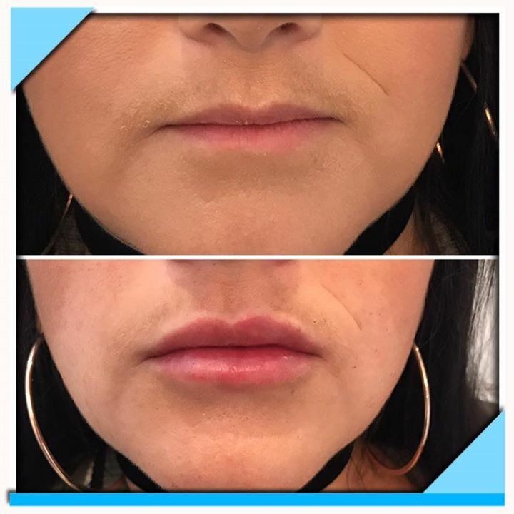 before and after