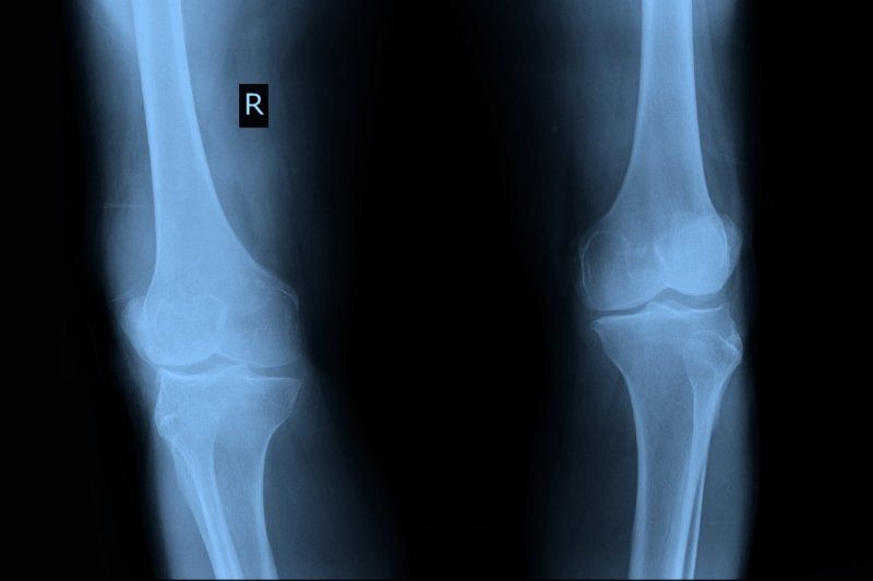 lastra radiologica