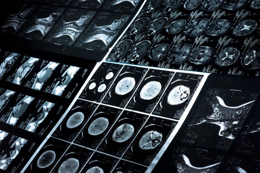 lastre radiologiche