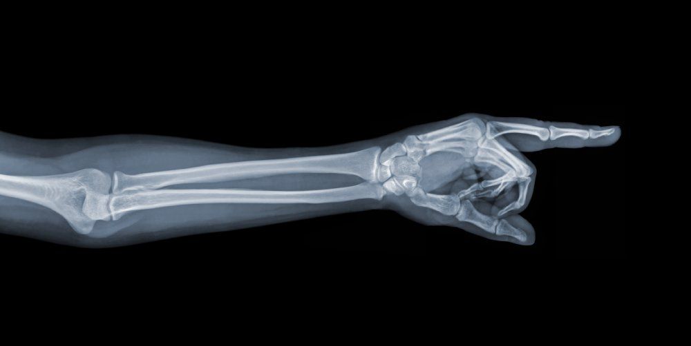lastra radiologica