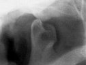 Radiologie Dentaire CIN Paris Daumesnil